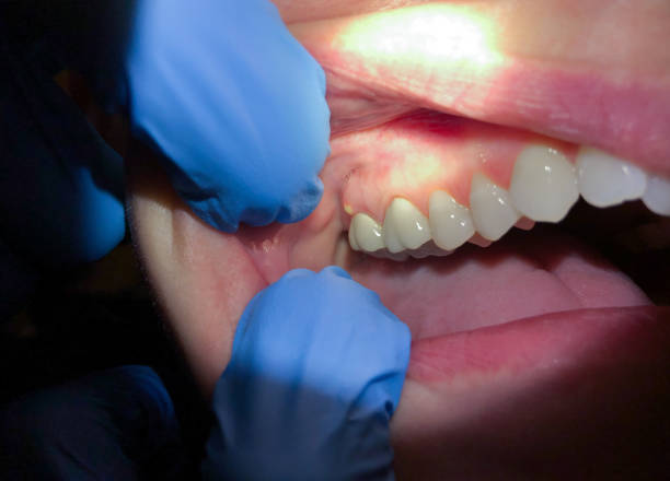 Best Emergency Cosmetic Dentistry (e.g., broken veneers) in Plattsburg, MO