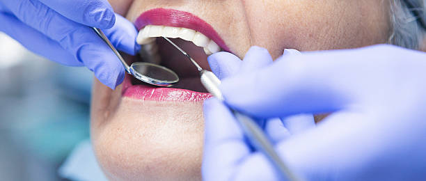 Best Emergency Care for Gum Disease in Plattsburg, MO